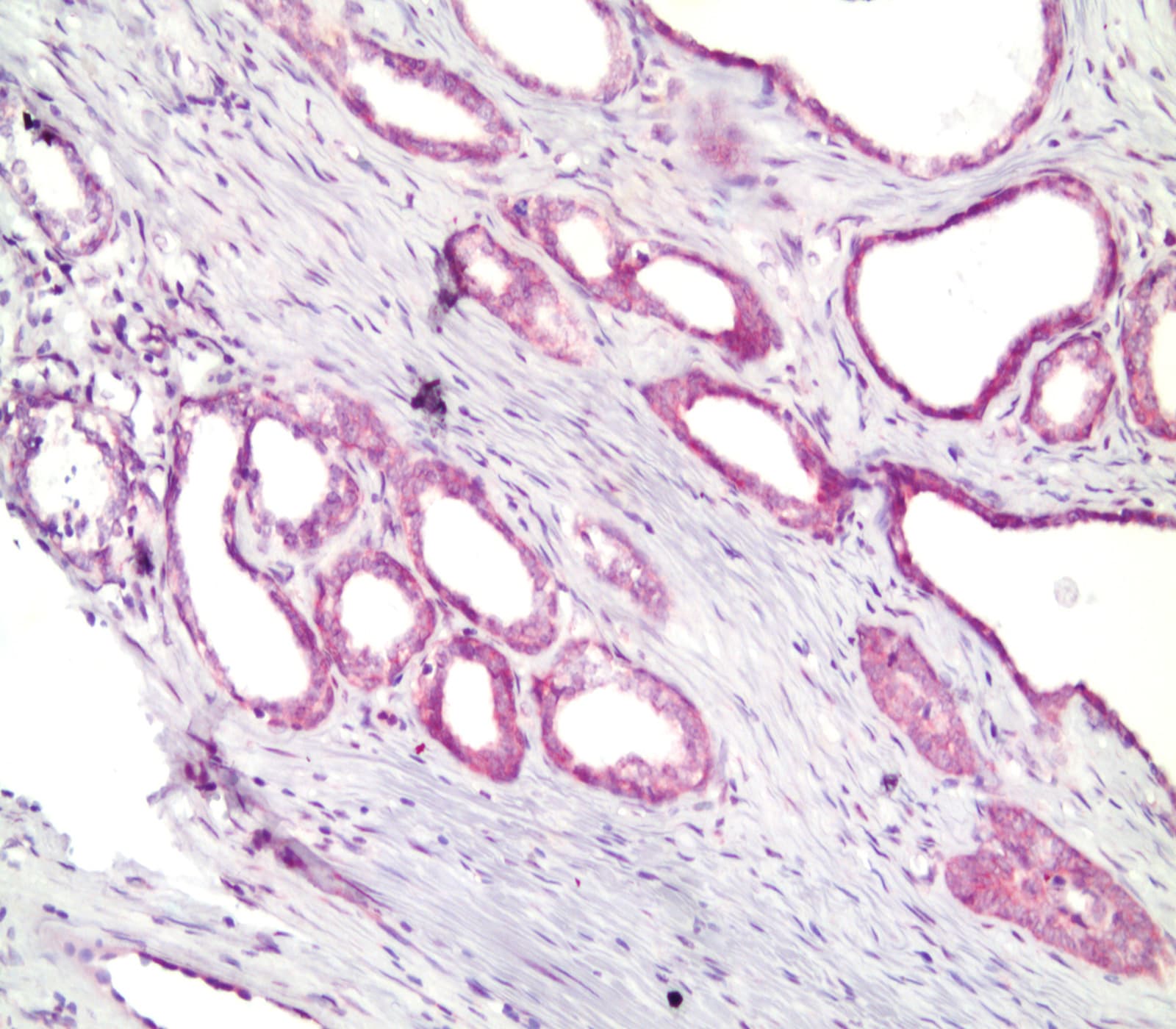 Enzo biomarker expression analysis — validated immunoassays and quantification platforms